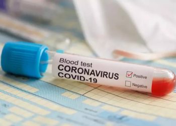 Besok, Kementerian BUMN Datangkan Alat Tes Corona Skala Besar dari Swiss