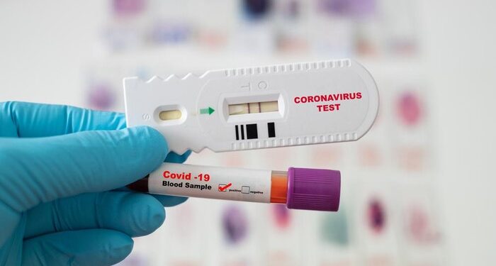 Rekomendasi WHO, Tes Rapid Antigen Untuk Mendiagnosa Covid-19